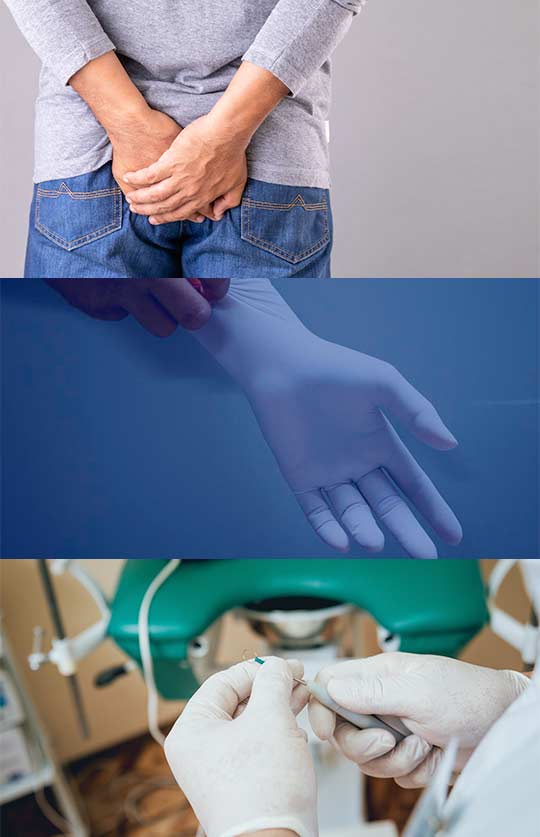 Quais doenças o médico proctologista pode tratar?